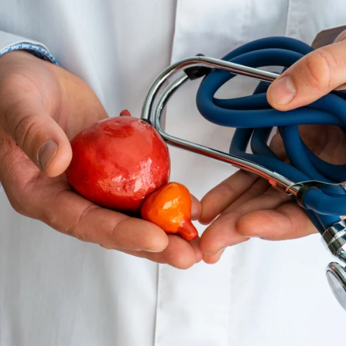 Imagen de: ANTÍGENO ESPECÍICO DE  PROSTATA PSA LIBRE