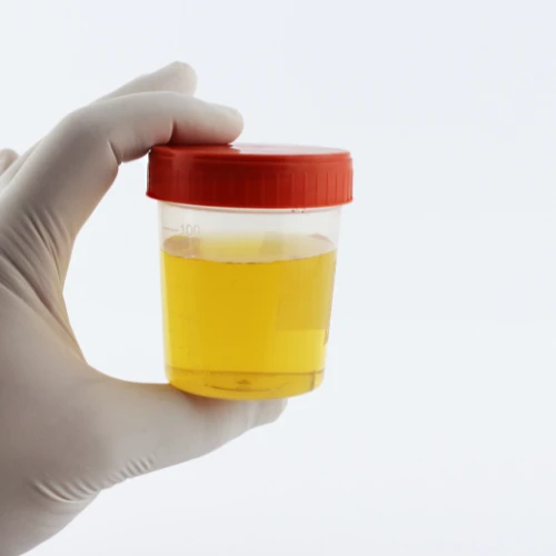 Imagen de: PROTEÍNAS TOTALES ORINA 24 HRS.